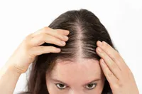 夏抜け毛の原因と予防法|頭皮ケア・スケーリング・紫外線対策まで徹底解説