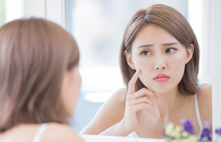 ニキビ・毛穴管理の最強対策:イソトレチノイン