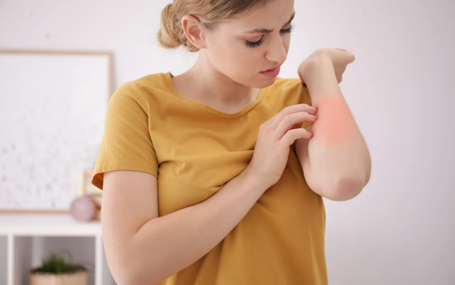 アトピー性皮膚炎とあせもの詳細比較