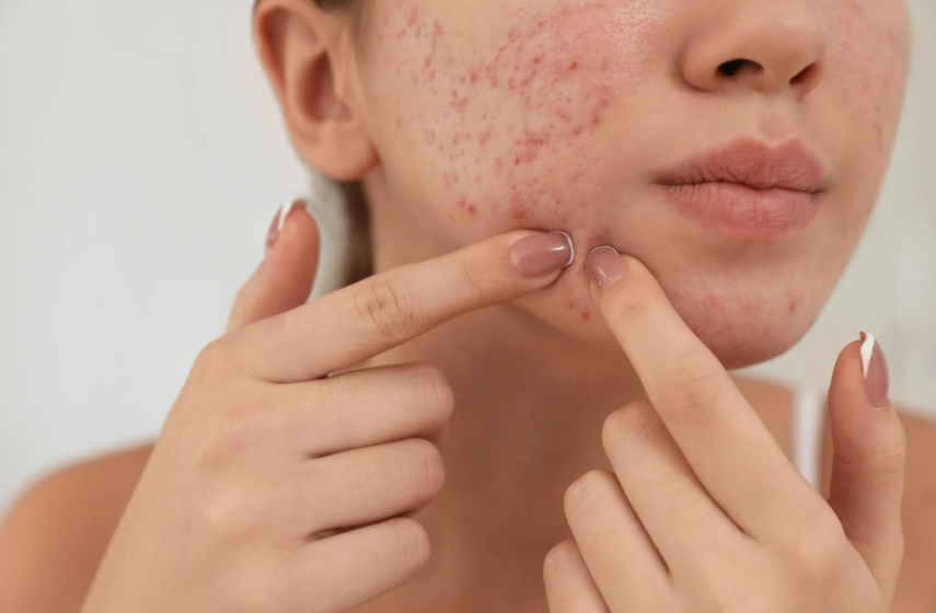 皮膚トラブルは安と外、同時にケアが必要