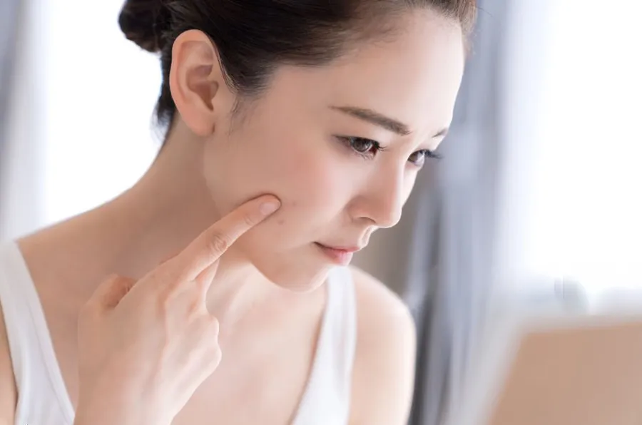 皮脂過多で生じる皮膚問題は?