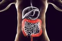 便秘の原因と解消法｜腸活・プロバイオティクス効果からオンライン診療まで